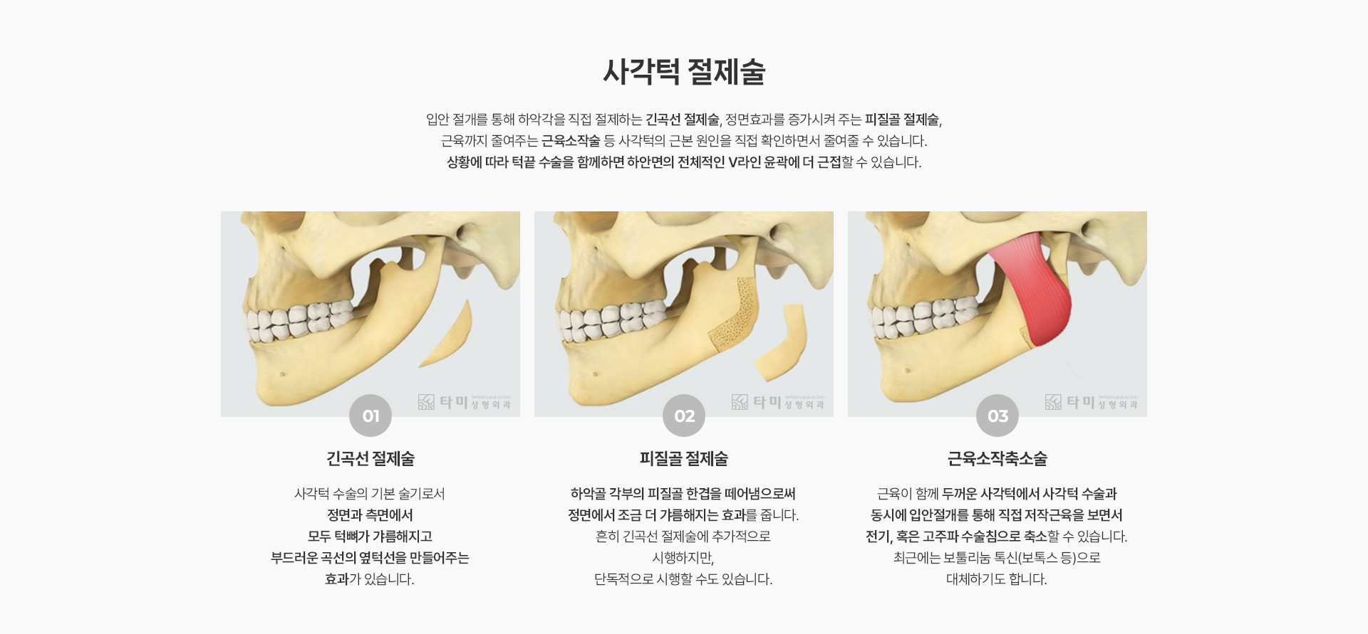 얼굴성형